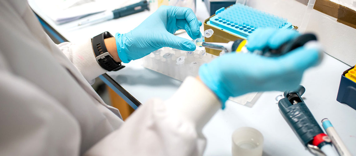 Researcher investigating the poly (ADP-ribose) glycohydrolase (PARG) enzyme and how it might be used to treat ovarian cancer.