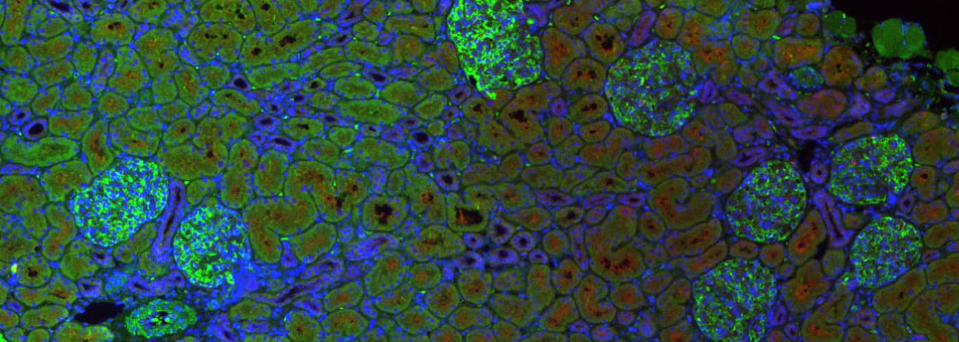 Microscopic image of human biopsy.