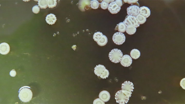 A close up of a petri dish showing a brown jelly like substance and white dots growing on top.