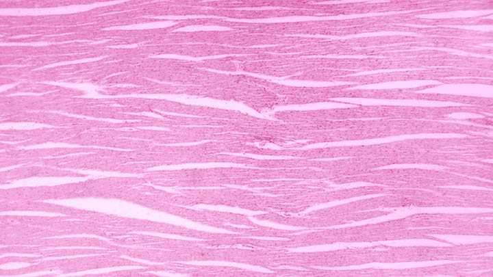 Cardiac muscle section under light microscope.