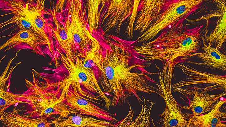 Real fluorescence microscopic view of human skin cells in culture.