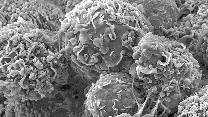 SEM image of human cells.
