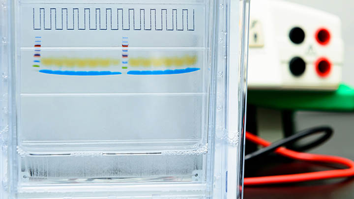 Protein ladder and protein samples separated by molecular mass.