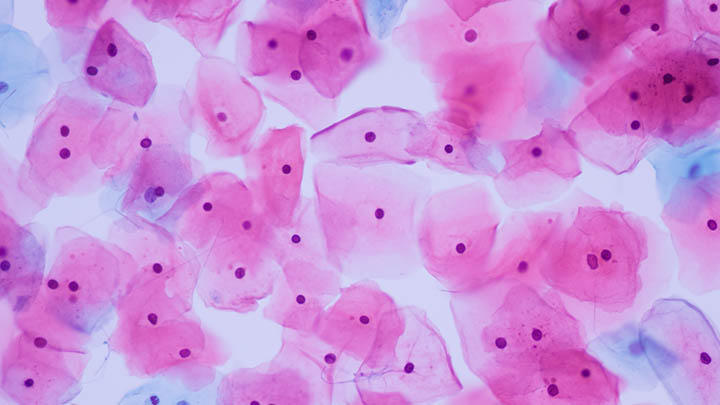 Normal human cervix cells under the microscope.