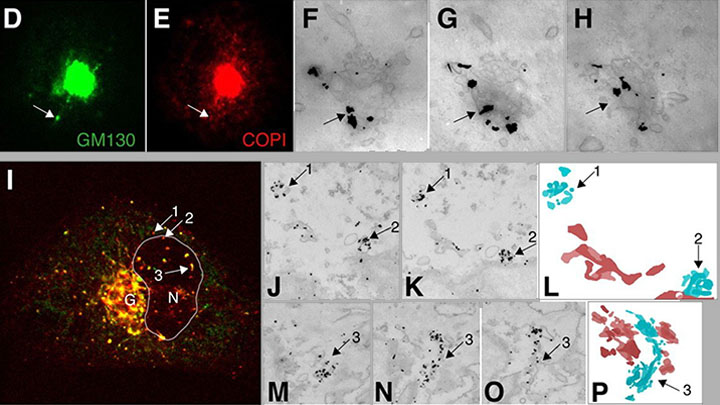 Correlative light-electron microscopy image.