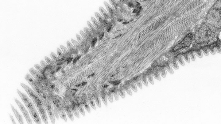 A TEM image of a larvae.