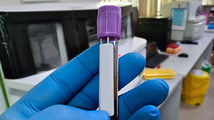 Researcher preparing a sample for a flow cytometer.