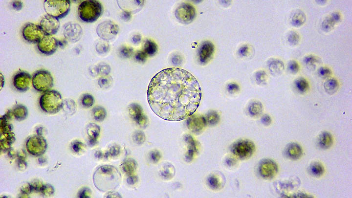 CRISPR plant cells (protoplast) used for coronavirus vaccine.