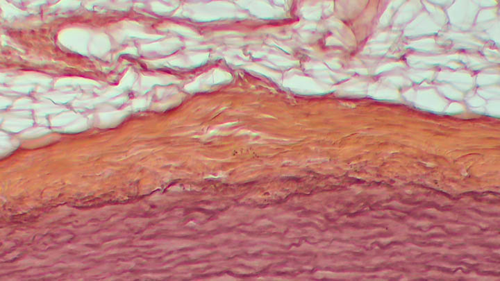 Histological section of an elastic artery (human aorta). Orcein staining.