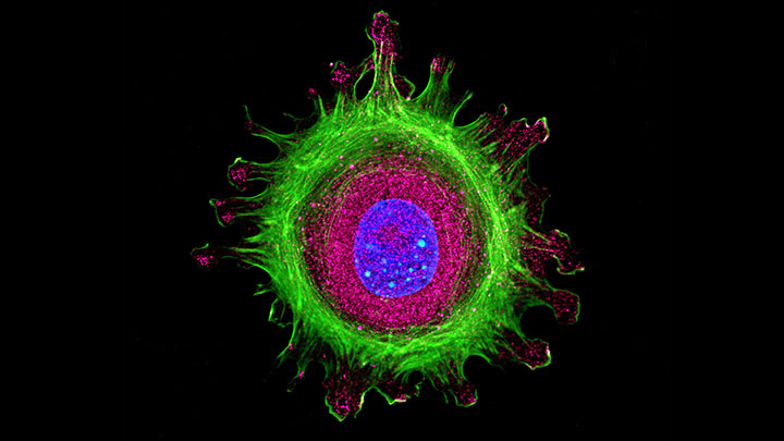 Single human cell stained with multiple antibodies.