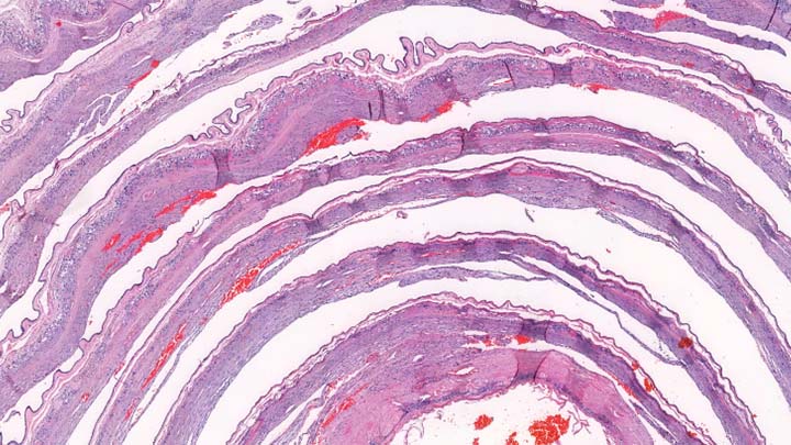 H&E staining on mouse skin 'rolled up' and cross sectioned.