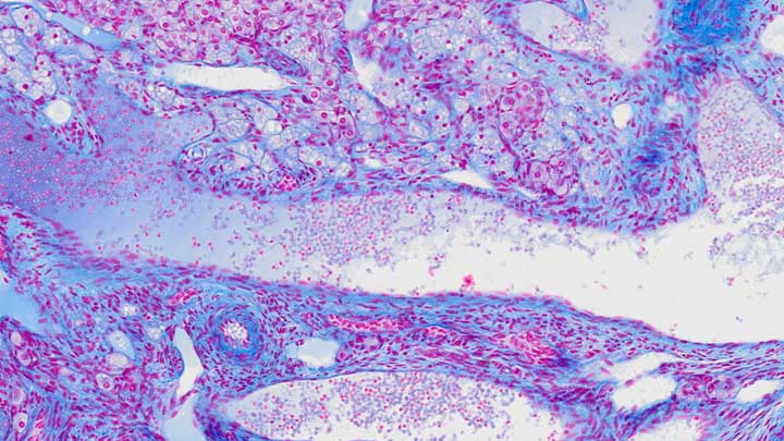 Histological section of the ovary stained with Masson's trichrome.