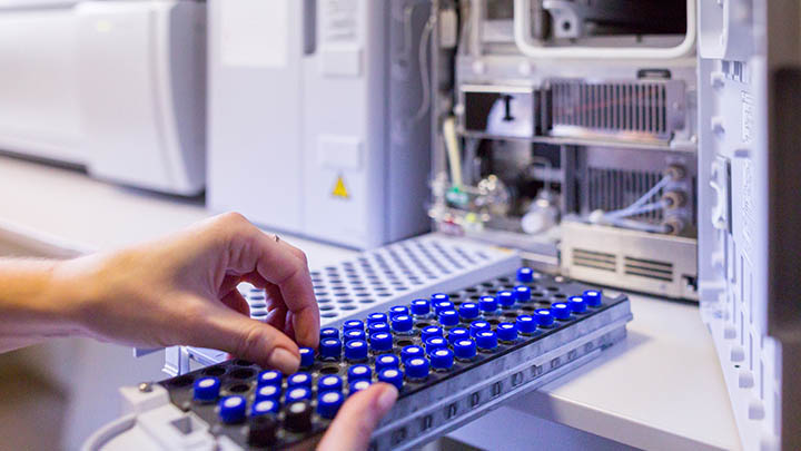 Technician prepares samples to load into mass spectrometer.