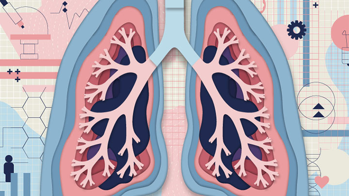 An illustration of lungs