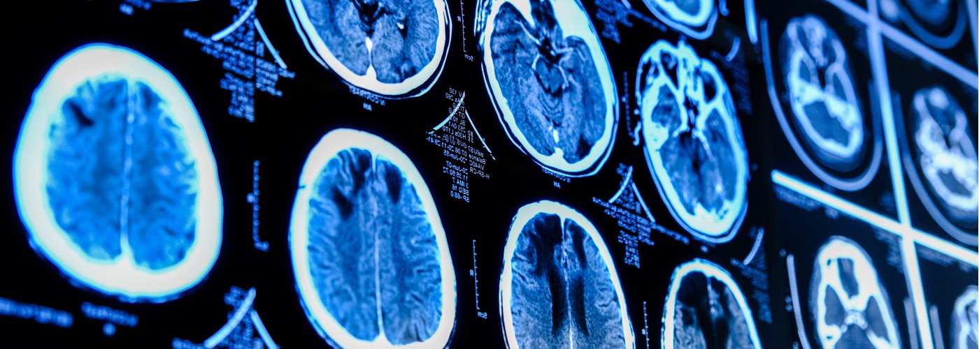 Close-up of CT scan of the brain.
