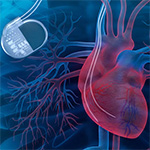 Illustration of a person's chest showing the heart and lungs, and a pacemaker.