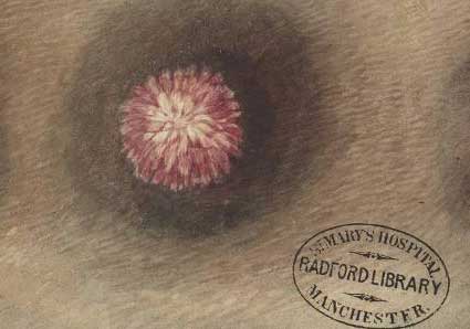 Blood Vessels Thomas Radford, VFA.8.54.