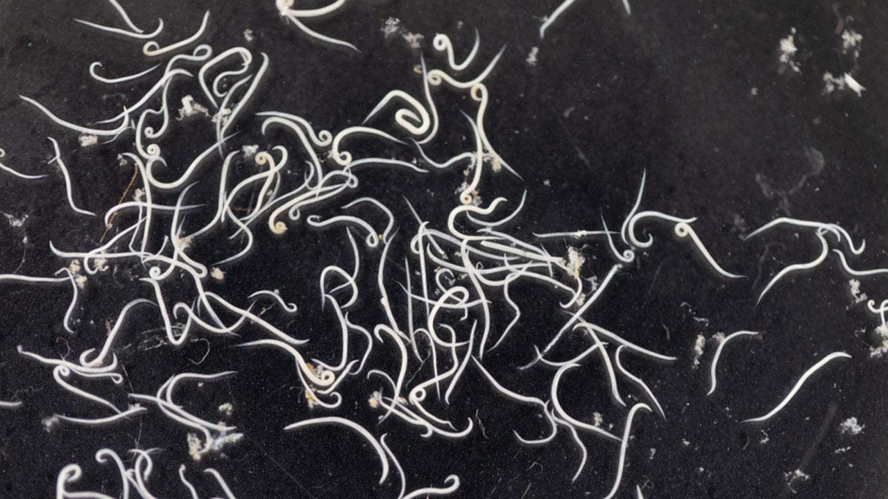 Parasitic roundworm Ascaris lumbricoides