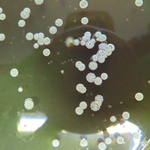 A Petri dish with brown jelly with white spots on top.