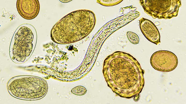 Parasitic worms - helminths - under the microscope.