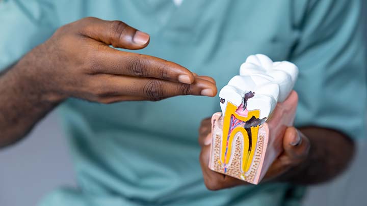 A dental model.