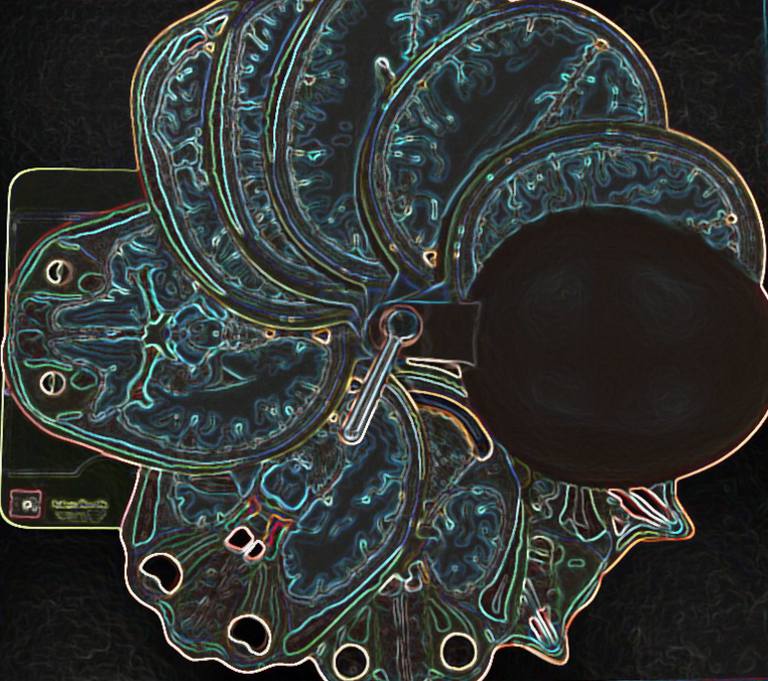 Model showing the brain sectioned at different levels.