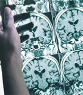 Researcher looking at MRI scans.