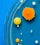 Bacteria in a petri dish against a blue background.