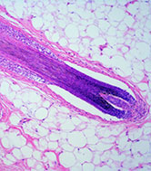 Microscope image with a purple elongated shape and white background.