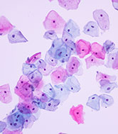 Purple and pink microscopic image of skin cells.
