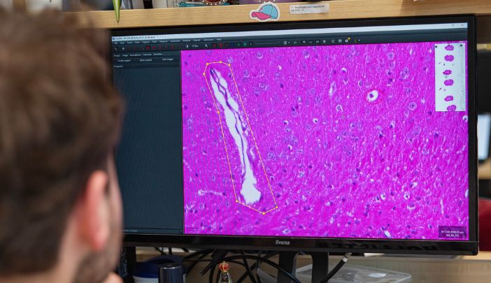 A researcher looking at a screen