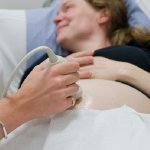 Pregnant person having ultrasound scan procedure.